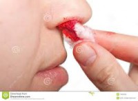 /album/fotogaleria-hemorragias/descarga-jpg/